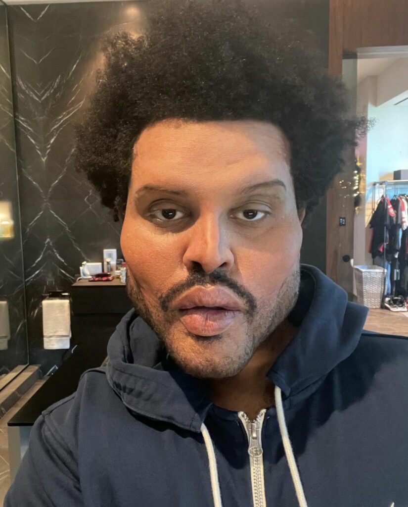 The Weeknd mostra il nuovo look dopo la finta chirurgia plastica nel video musicale del singolo 'Save Your Tears'.