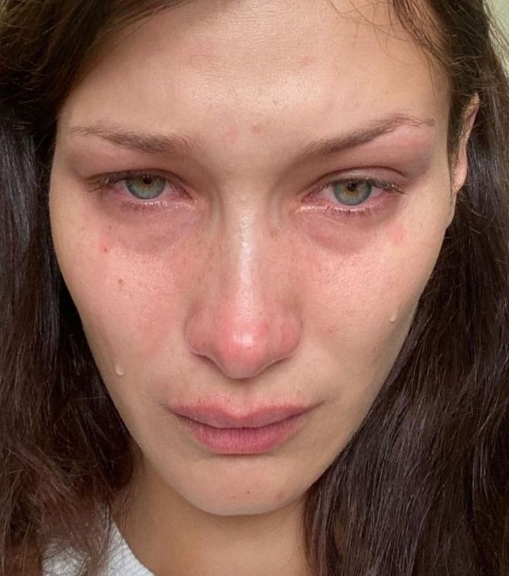Bella Hadid: mostra le lacrime su Instagram La modella soffre di depressione.